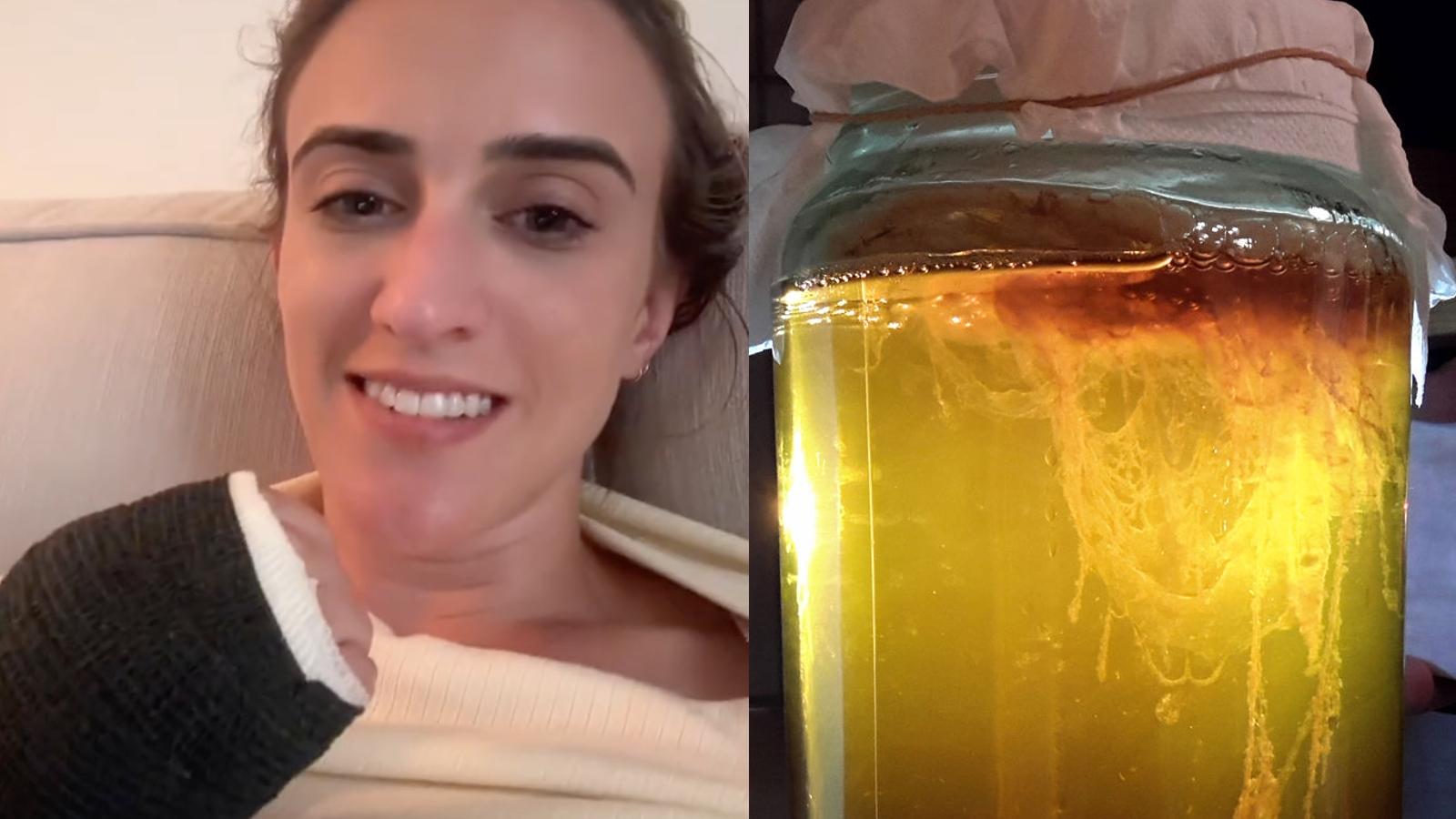 Viral kombucha woman